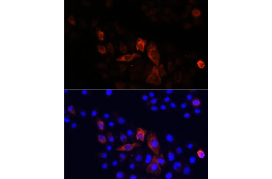 Immunofluorescence - Anti-NADH2 [9E12-1B3] Antibody (A92937) - Antibodies.com