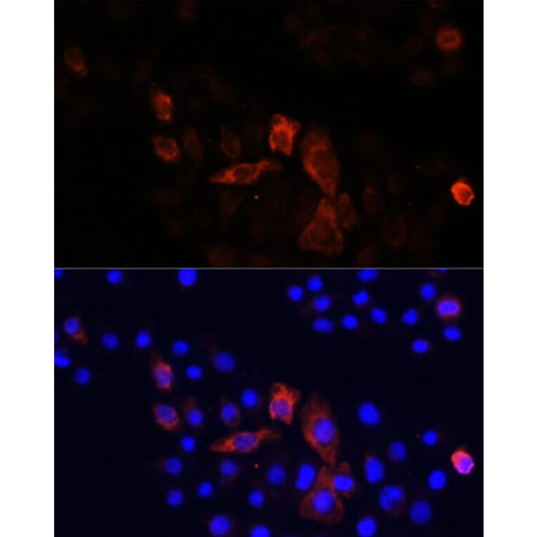Immunofluorescence - Anti-NADH2 [9E12-1B3] Antibody (A92937) - Antibodies.com