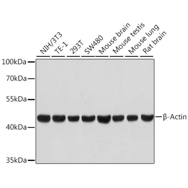 Western Blot - Anti-beta Actin Antibody [ARC5115-01] (A92938) - Antibodies.com