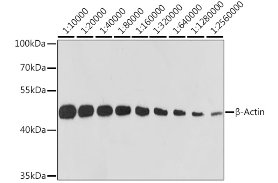 Western Blot - Anti-beta Actin Antibody [ARC5115-01] (A92938) - Antibodies.com