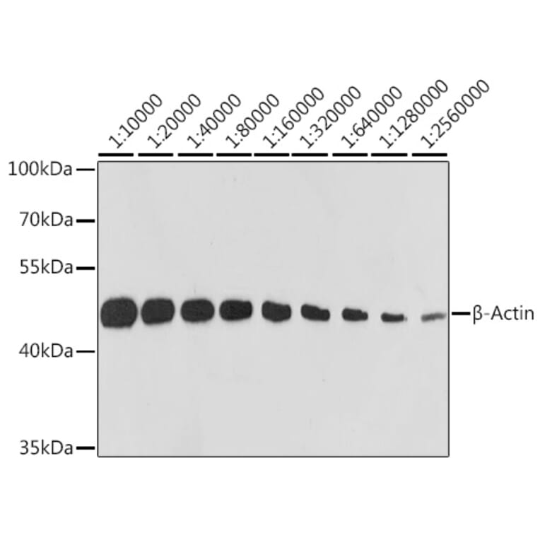 Western Blot - Anti-beta Actin Antibody [ARC5115-01] (A92938) - Antibodies.com