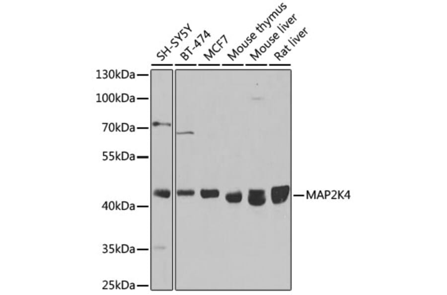 Western Blot - Anti-MEK4/MKK4 Antibody (A92939) - Antibodies.com