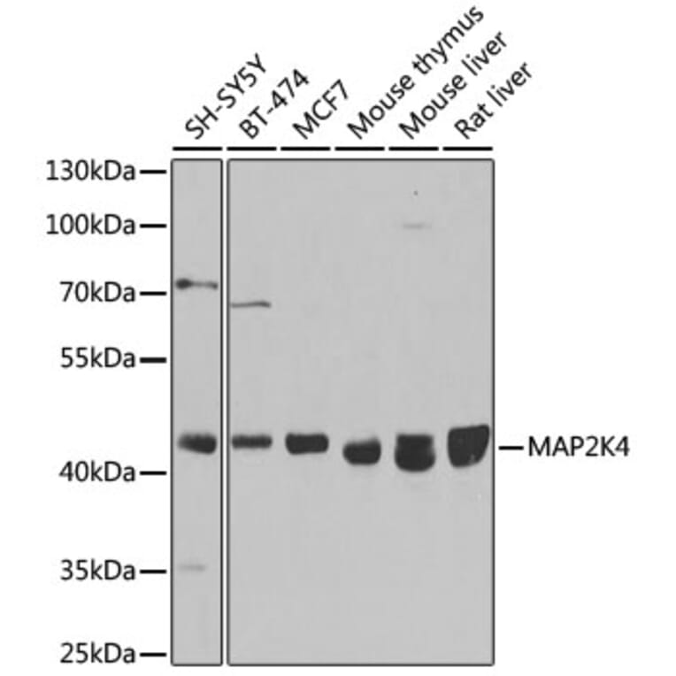 Western Blot - Anti-MEK4/MKK4 Antibody (A92939) - Antibodies.com