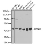 Western Blot - Anti-MEK4/MKK4 Antibody (A92939) - Antibodies.com