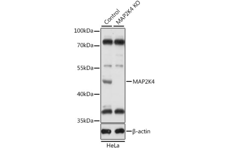 Western Blot - Anti-MEK4/MKK4 Antibody (A92939) - Antibodies.com