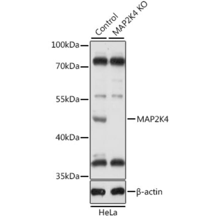 Western Blot - Anti-MEK4/MKK4 Antibody (A92939) - Antibodies.com