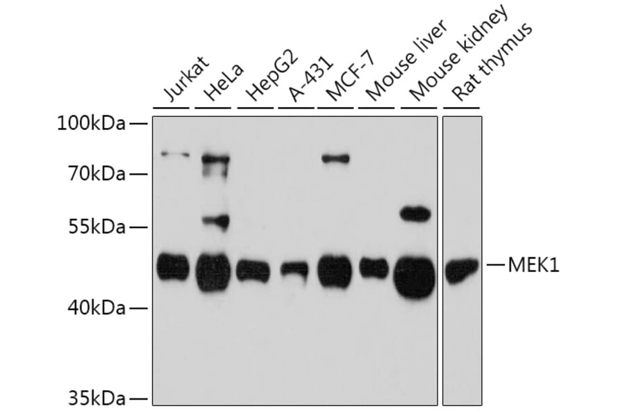 Western Blot - Anti-MEK1 Antibody (A92940) - Antibodies.com