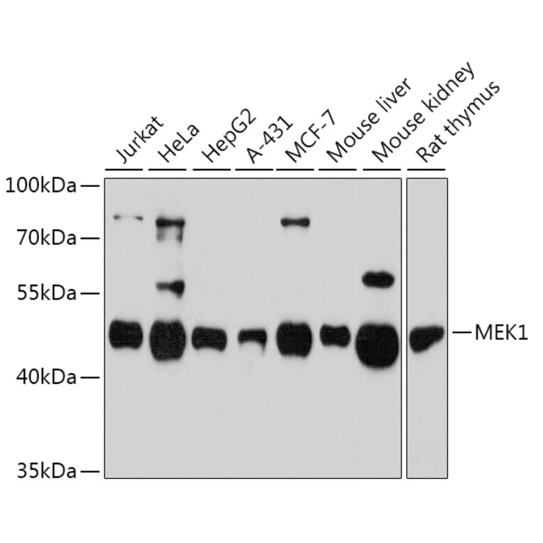 Western Blot - Anti-MEK1 Antibody (A92940) - Antibodies.com