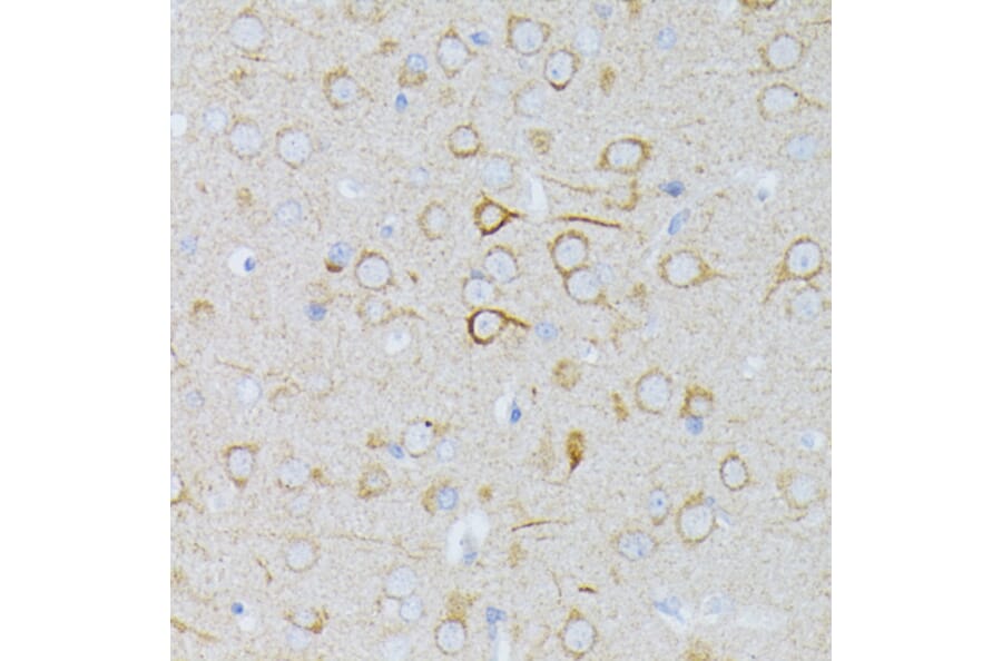 Immunohistochemistry - Anti-MEK1 Antibody (A92940) - Antibodies.com