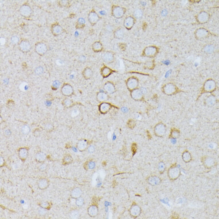 Immunohistochemistry - Anti-MEK1 Antibody (A92940) - Antibodies.com