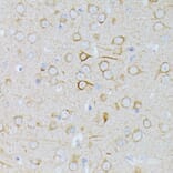 Immunohistochemistry - Anti-MEK1 Antibody (A92940) - Antibodies.com