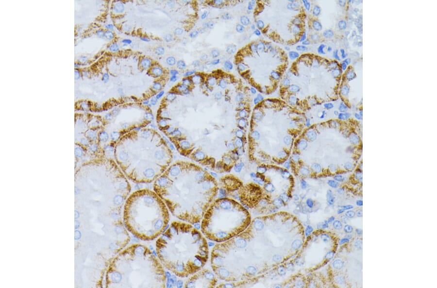 Immunohistochemistry - Anti-MEK1 Antibody (A92940) - Antibodies.com