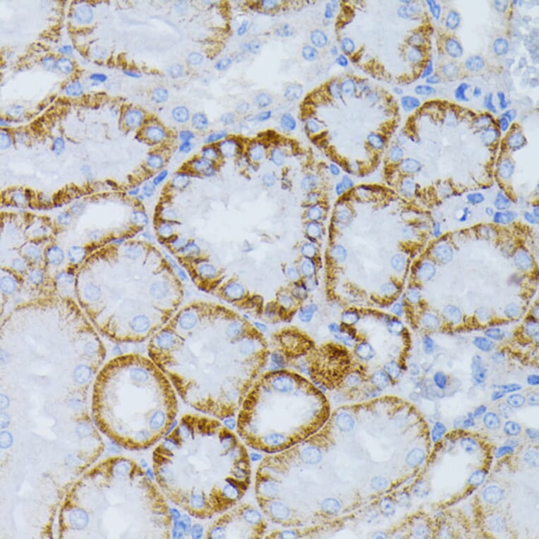 Immunohistochemistry - Anti-MEK1 Antibody (A92940) - Antibodies.com