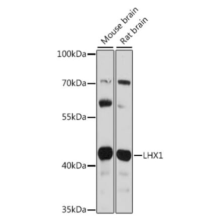 Western Blot - Anti-LIM1 Antibody (A92941) - Antibodies.com