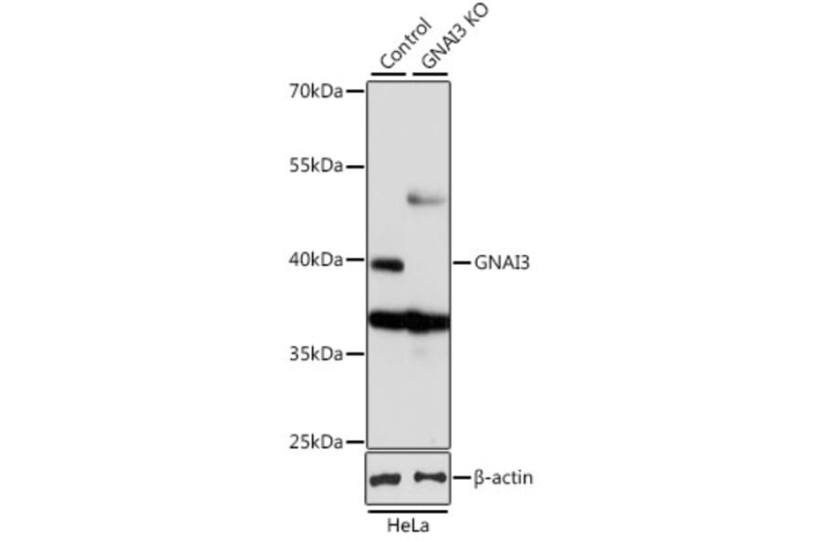 Western Blot - Anti-GNAI3 Antibody (A92943) - Antibodies.com