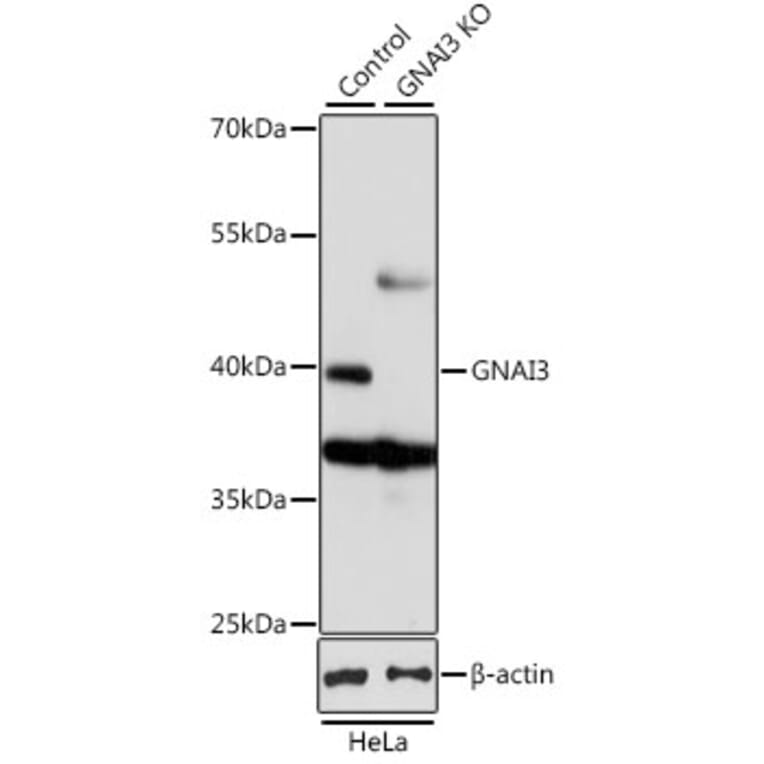 Western Blot - Anti-GNAI3 Antibody (A92943) - Antibodies.com