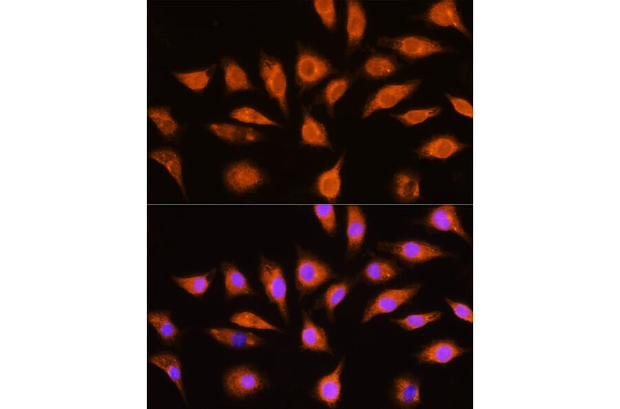 Immunofluorescence - Anti-GNAI3 Antibody (A92943) - Antibodies.com