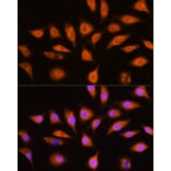 Immunofluorescence - Anti-GNAI3 Antibody (A92943) - Antibodies.com