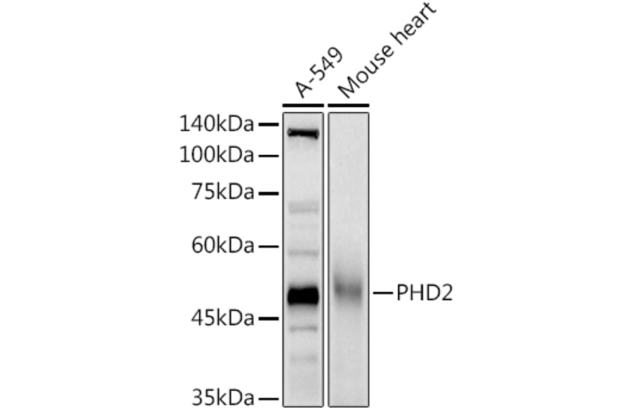 Western Blot - Anti-PHD2/prolyl hydroxylase Antibody (A92945) - Antibodies.com