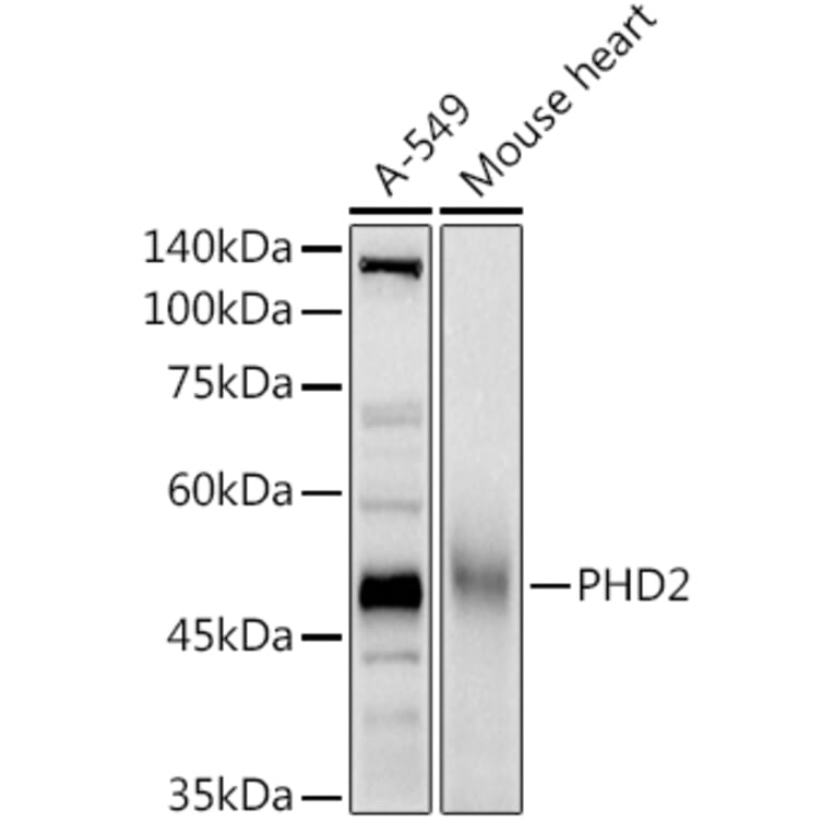 Western Blot - Anti-PHD2/prolyl hydroxylase Antibody (A92945) - Antibodies.com
