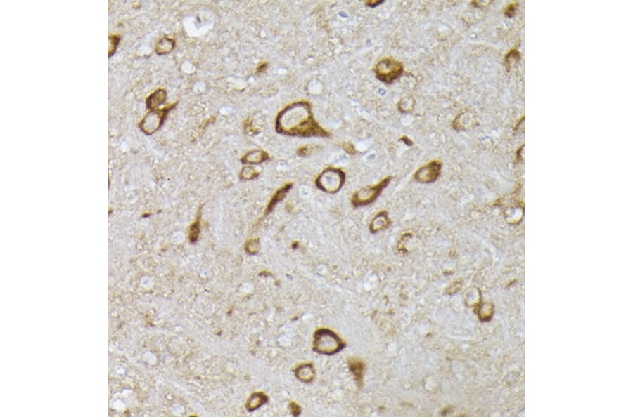 Immunohistochemistry - Anti-PHD2/prolyl hydroxylase Antibody (A92945) - Antibodies.com