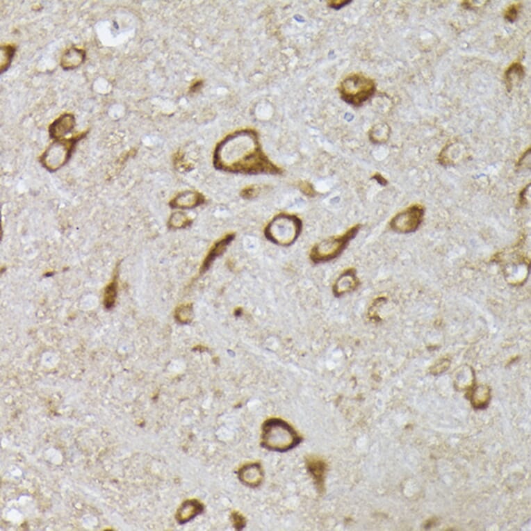 Immunohistochemistry - Anti-PHD2/prolyl hydroxylase Antibody (A92945) - Antibodies.com