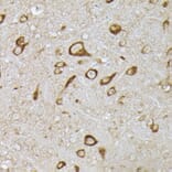 Immunohistochemistry - Anti-PHD2/prolyl hydroxylase Antibody (A92945) - Antibodies.com