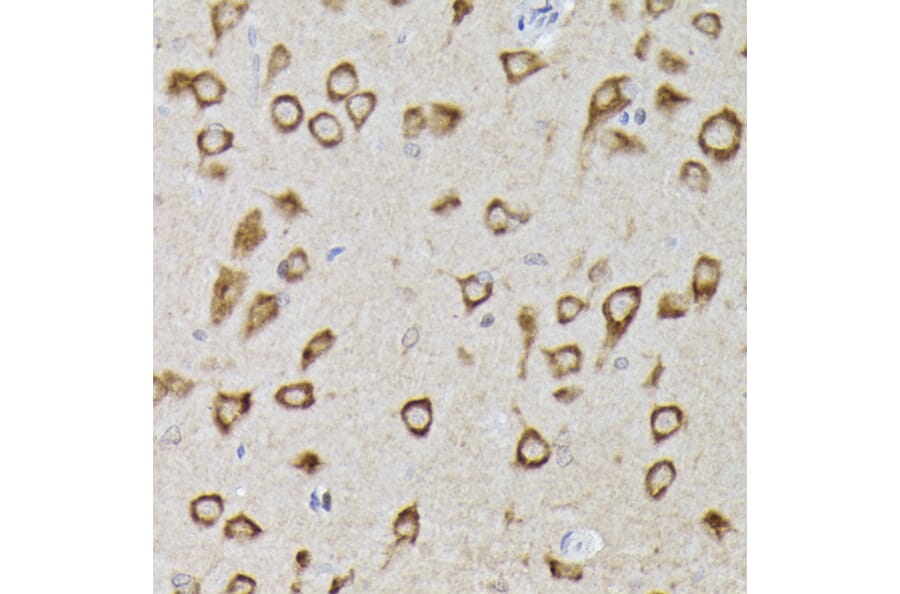 Immunohistochemistry - Anti-PHD2/prolyl hydroxylase Antibody (A92945) - Antibodies.com