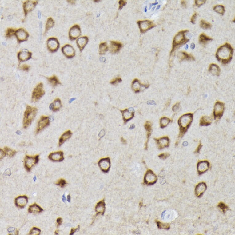 Immunohistochemistry - Anti-PHD2/prolyl hydroxylase Antibody (A92945) - Antibodies.com