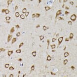 Immunohistochemistry - Anti-PHD2/prolyl hydroxylase Antibody (A92945) - Antibodies.com