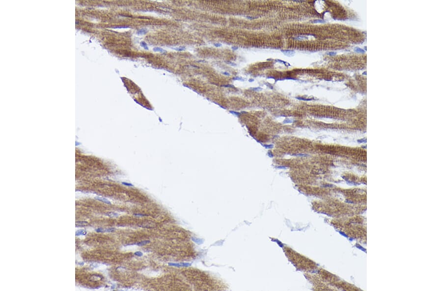 Immunohistochemistry - Anti-PHD2/prolyl hydroxylase Antibody (A92945) - Antibodies.com