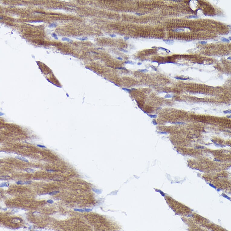 Immunohistochemistry - Anti-PHD2/prolyl hydroxylase Antibody (A92945) - Antibodies.com