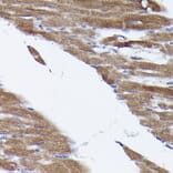 Immunohistochemistry - Anti-PHD2/prolyl hydroxylase Antibody (A92945) - Antibodies.com