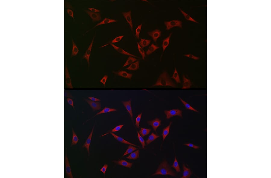 Immunofluorescence - Anti-PHD2/prolyl hydroxylase Antibody (A92945) - Antibodies.com