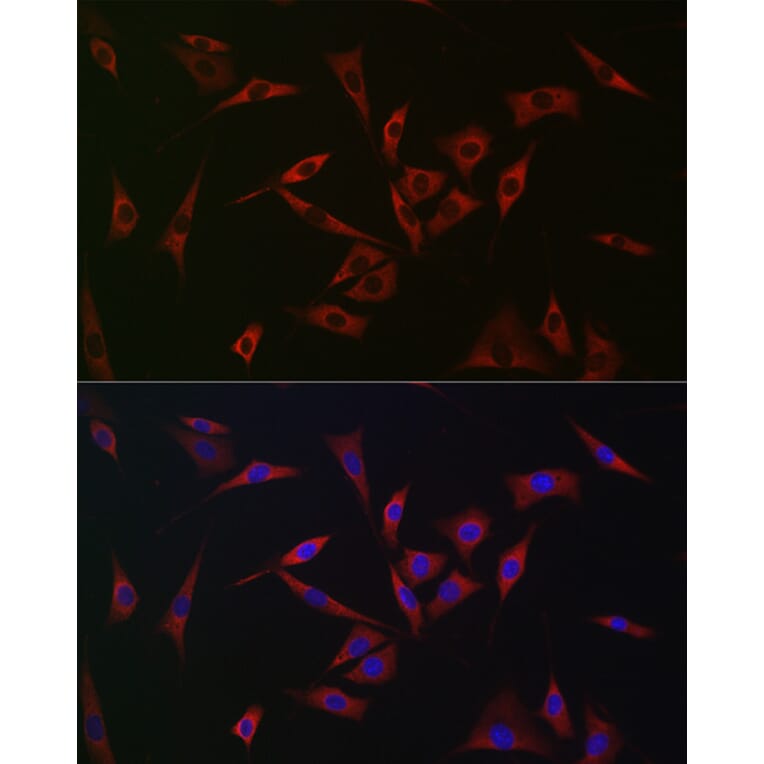 Immunofluorescence - Anti-PHD2/prolyl hydroxylase Antibody (A92945) - Antibodies.com