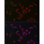 Immunofluorescence - Anti-PHD2/prolyl hydroxylase Antibody (A92945) - Antibodies.com