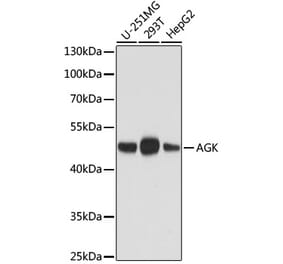Western Blot - Anti-AGK Antibody [AMC0020] (A92946) - Antibodies.com