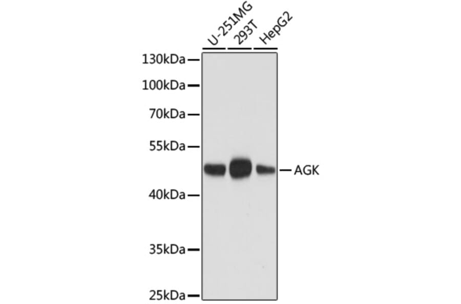 Western Blot - Anti-AGK Antibody [AMC0020] (A92946) - Antibodies.com