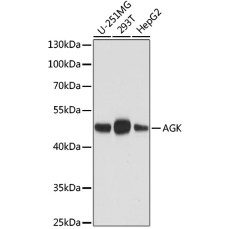 Western Blot - Anti-AGK Antibody [AMC0020] (A92946) - Antibodies.com