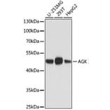 Western Blot - Anti-AGK Antibody [AMC0020] (A92946) - Antibodies.com