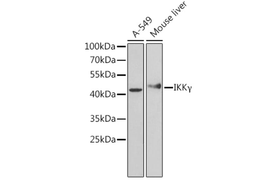 Western Blot - Anti-IKK gamma/NEMO Antibody (A92948) - Antibodies.com