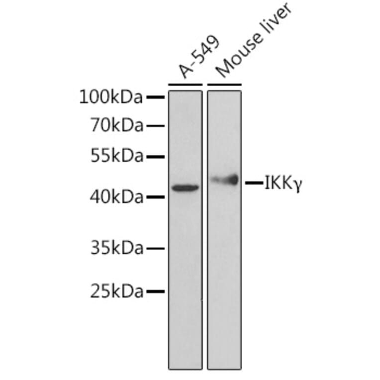 Western Blot - Anti-IKK gamma/NEMO Antibody (A92948) - Antibodies.com