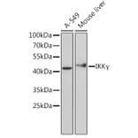 Western Blot - Anti-IKK gamma/NEMO Antibody (A92948) - Antibodies.com