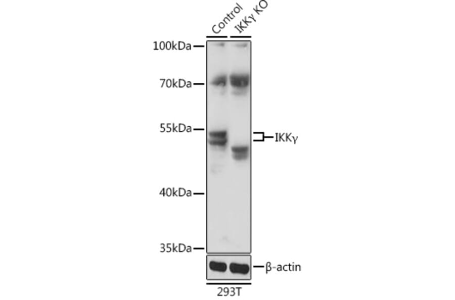 Western Blot - Anti-IKK gamma/NEMO Antibody (A92948) - Antibodies.com