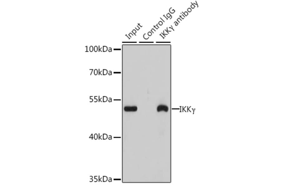 Western Blot - Anti-IKK gamma/NEMO Antibody (A92948) - Antibodies.com
