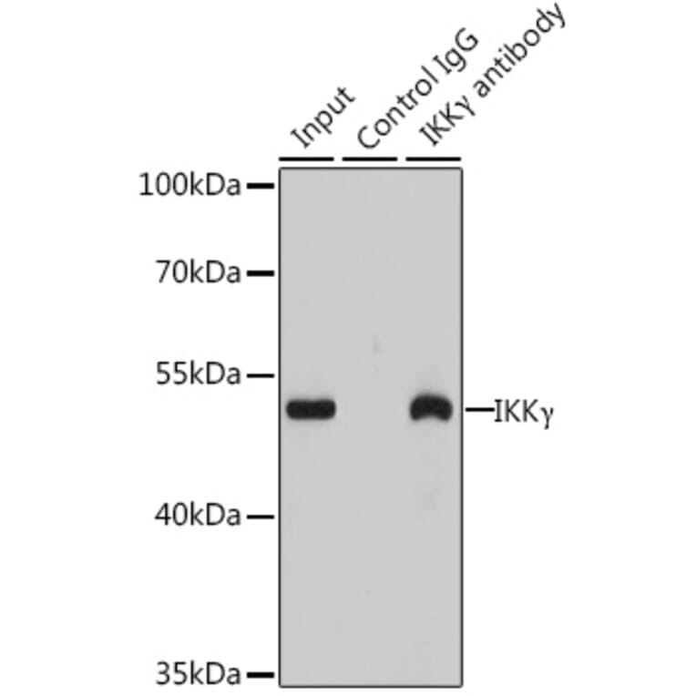 Western Blot - Anti-IKK gamma/NEMO Antibody (A92948) - Antibodies.com