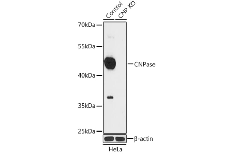 Western Blot - Anti-CNPase Antibody (A92949) - Antibodies.com