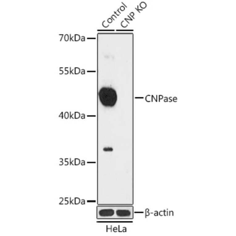 Western Blot - Anti-CNPase Antibody (A92949) - Antibodies.com
