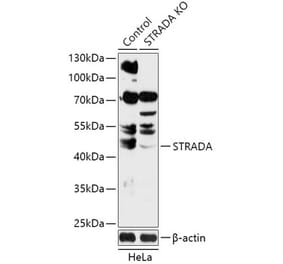 Western Blot - Anti-STRAD Antibody (A92952) - Antibodies.com