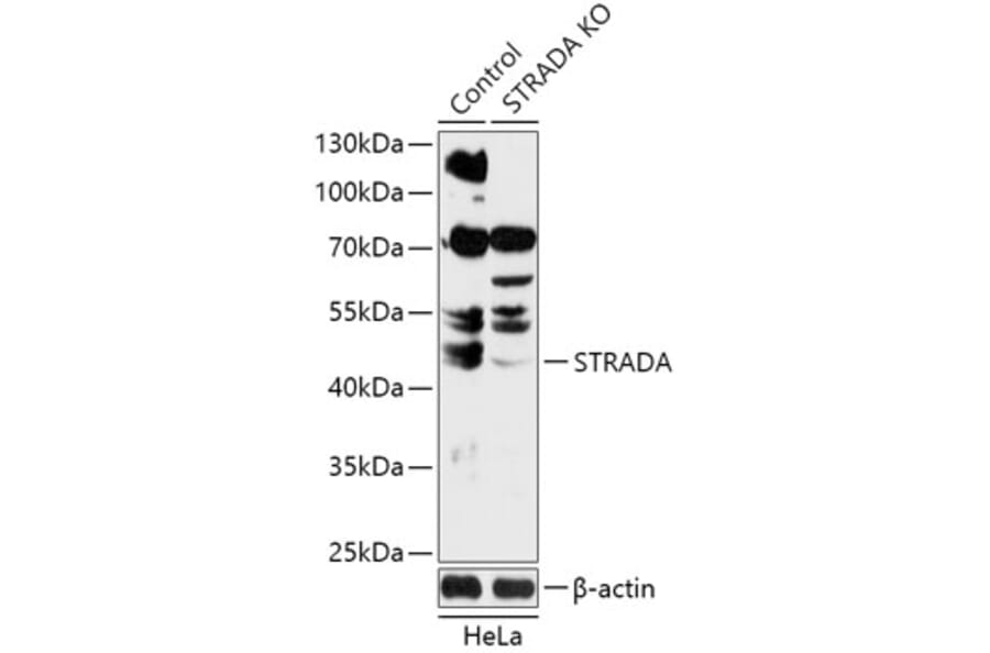 Western Blot - Anti-STRAD Antibody (A92952) - Antibodies.com
